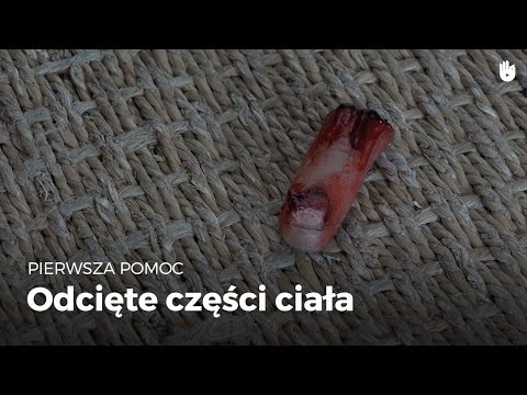 Kość stopy stóp Typy płasko-koślawe wkładek