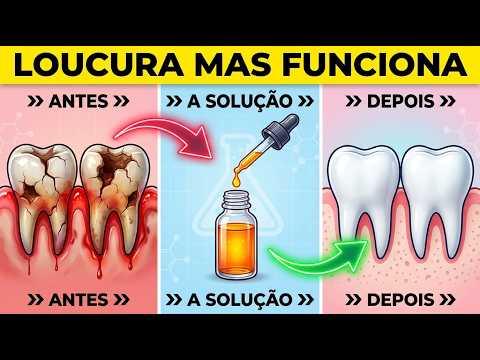 Esqueça o enxaguante bucal — Este óleo mata as bactérias nocivas da GENGIVA