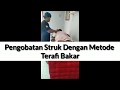 Pengobatan Struk Dengan Terafi Api Alhamdulillah Langsung Ada Per