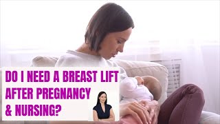 Do I Need a Breast Lift After Pregnancy / Breastfeeding? Find out HERE!