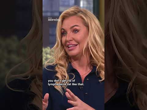 Following her lipoedema diagnosis, Josie Gibson breaks down how it affects her body.