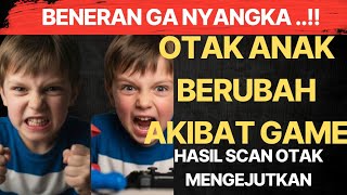 Download lagu Anak Kecanduan Game? Ternyata Ini yang Terjadi pada Otaknya! mp3