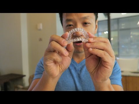 download lagu mp3 mp4 Invisalign Taiwan, download lagu Invisalign Taiwan gratis, unduh video klip Invisalign Taiwan