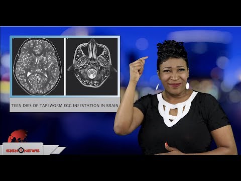 Sign1News 3.29.19 - News for the Deaf community powered by CNN in American Sign Language (ASL)