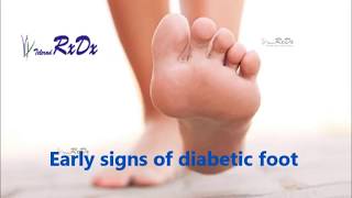 Early Signs of Diabetic Foot