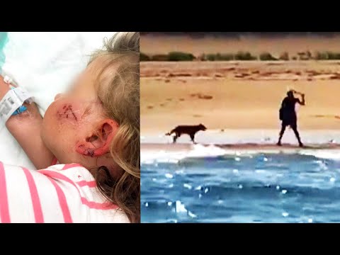 Cape Cod Coyote Attacks 3-Year-Old on the Beach