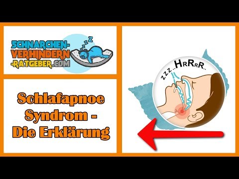 Schlafapnoe Syndrom - Die Erklärung! 💯