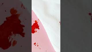 How to get blood out of clothes?