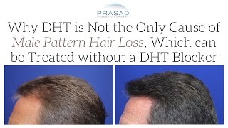 Hair Loss Treatment: PRP is Not a DHT Blocker, but DHT is Not the Only Cause of Pattern Hair Loss