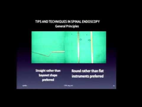 Pearls & Pit falls in Spinal endoscopy