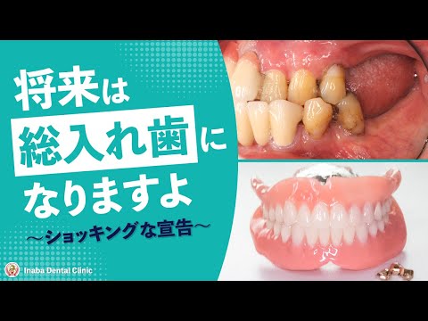 将来は総入れ歯になりますよ〜ショッキングな宣告〜