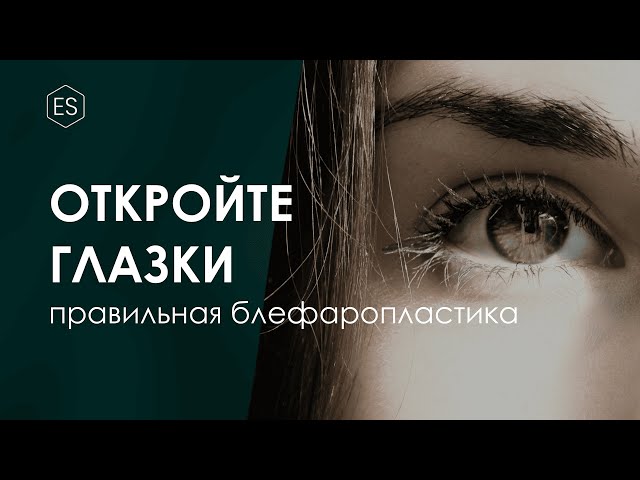 ПРАВИЛЬНАЯ БЛЕФАРОПЛАСТИКА