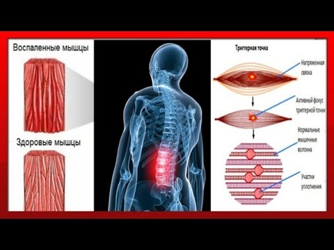 Болит поясница на 32 недели Если болят сразу несколько суставов