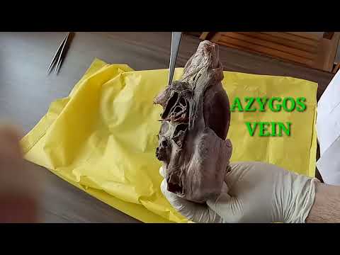 HEART PART-1 EXTERNAL FEATURES BY DR MITESH DAVE