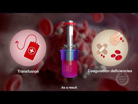 Rotational Thromboelastometry in Trauma