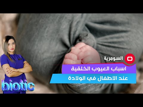شاهد بالفيديو.. اسباب العيوب الخلقية عند الاطفال في الولادة