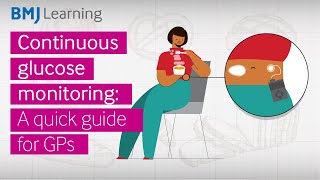 Continuous glucose monitors (CGMs): A quick guide for GPs