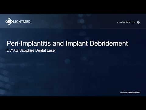 Peri-Implantitis and Implant Debridement with SAPPHIRE