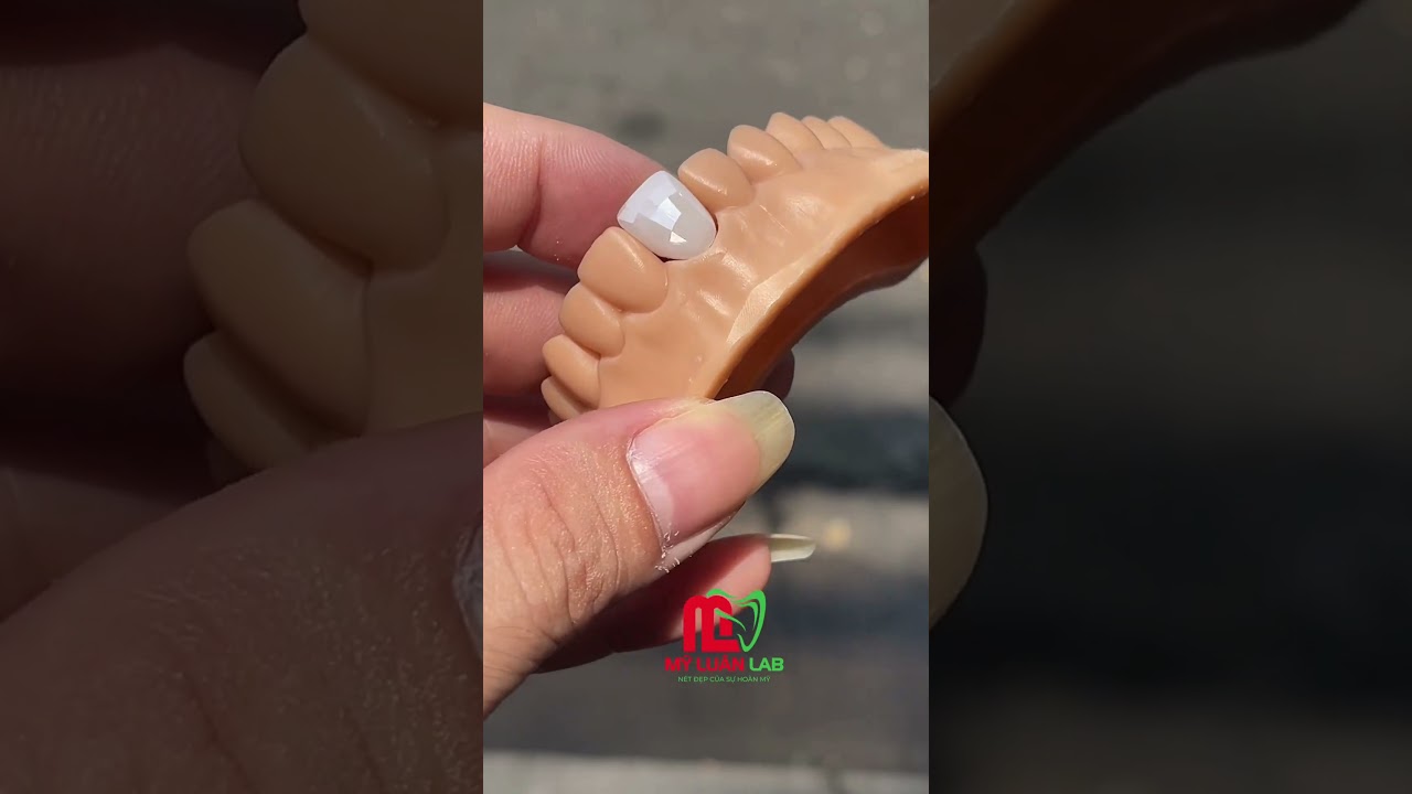 Mẫu tư vấn nha khoa giúp chốt khách