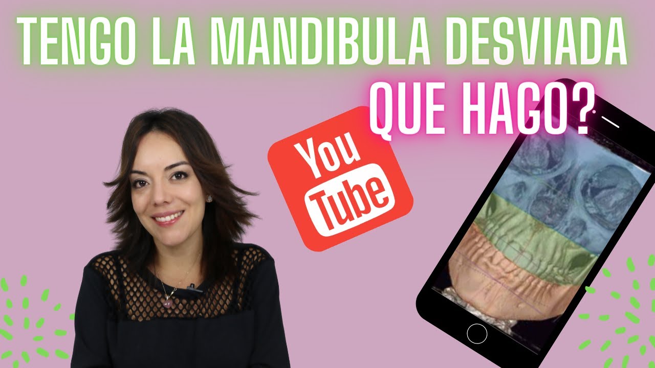 Watch TENGO LA MANDIBULA DESVIADA…. QUE HAGO Now TENGO LA MANDIBULA DESVIADA…. QUE HAGO