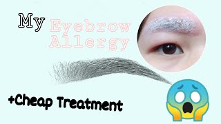 HOW TO CURE EYEBROW ALLERGIES (SEVERE EYEBROW ALLERGY) AT HOME