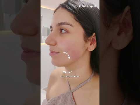 video Qi2xkGg29fI