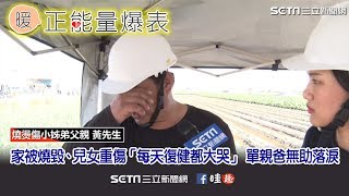 家被燒毀、兒女重傷「每天復健都大哭」　單親爸無助落淚