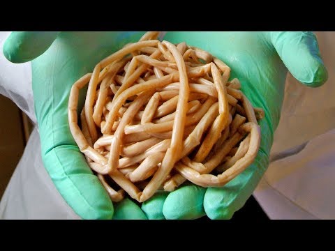 szemölcsök, mint enyhíti a viszketést
