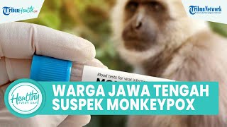 Kata Kepala Dinkes, Warga Jawa Tengah Suspek Monkeypox, Kenali Gejala hingga Cara Pencegahan