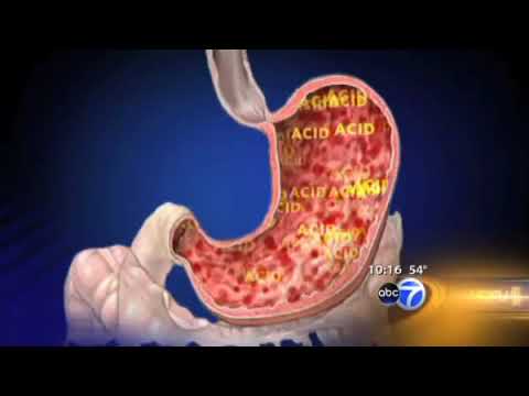 MMS at ABCnews HealthBeat oct 9, 2008 with Ohmega from MMS