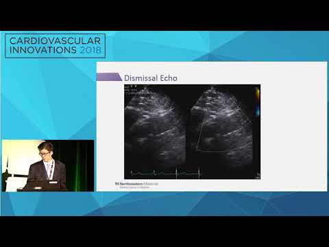 CVI2018 Session: I wish you had sent this patient to surgery - S. Chris Malaisrie, MD