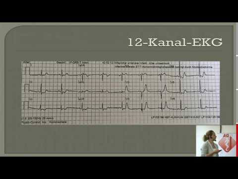 Fallbeispiel Herzinfarkt - Gudrun Sommer