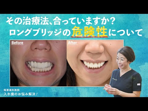 その治療法合っていますか？ロングブリッジの危険性について