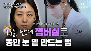 눈밑 주름, 다크서클, 꺼짐…? “이거 하나면 진짜 달라져요.” 닥터오블리 원장님이 직접 시술한 잼버실 리프팅 리얼 케이스 공개합니다!