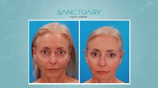 Sanctuary Plastic Surgery