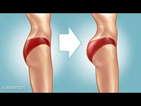 Schmerzen im Hüftgelenk Osteochondrose Behandlung von Verstauchungen des Sprunggelenks