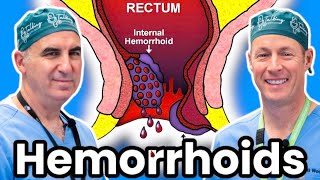 Hemorrhoids That Won’t Go Away?  How To Get Rid Of Them With And Without Surgery Once And For All