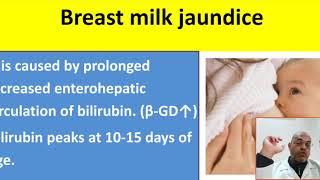 Part 4 breastfeeding vs breast milk jaundice, exaggerated  physiological jaundice, pathological jaun