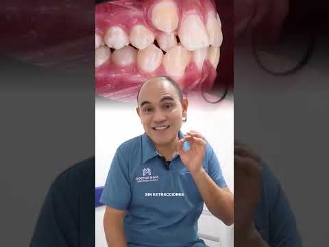 video QixlyeAZXDM
