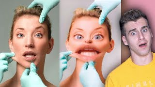 Girl Gets Surgery To Look Like Snapchat Filter!