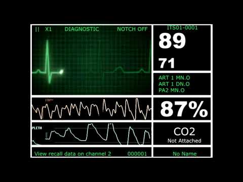 Hospital Monitor with FlatLine (L) (HD)