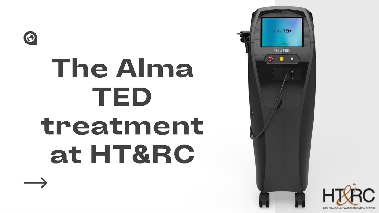 alma ted treatment