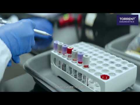 Torrent Diagnostics video thumbnail