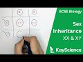 GCSE Biology Sex Inheritance XX XY Sex Chromosomes