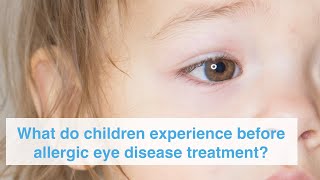What do children experience before allergic eye treatment?