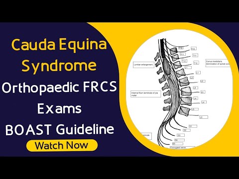 Cauda Equina for Orthopaedic Exams