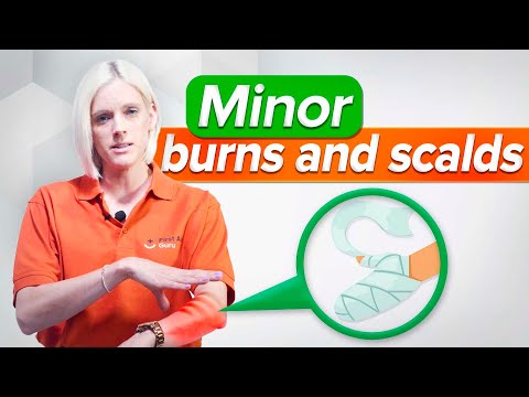 Minor Burns And Scalds  - First Aid Training Ep13 (2022)