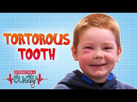 Torturous Tooth | Operation Ouch