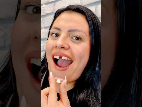 🚨THIS IS INCREDIBLE @mrdentures