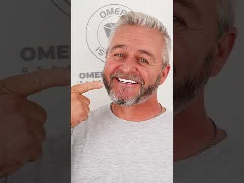 Dental Implants Before After - This Is How Dental Implants Make You Younger #shorts